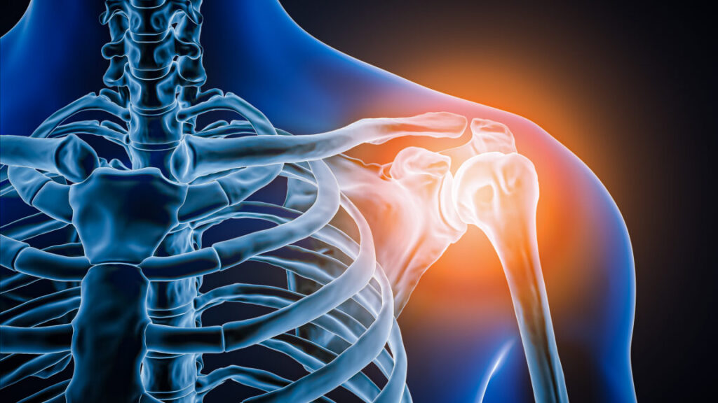 Doctors took a look at man&rsquo;s painful shoulder—they found the joint was missing