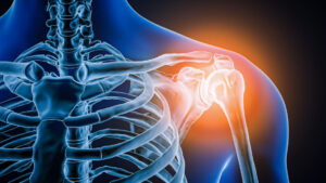 Doctors took a look at man&rsquo;s painful shoulder—they found the joint was missing