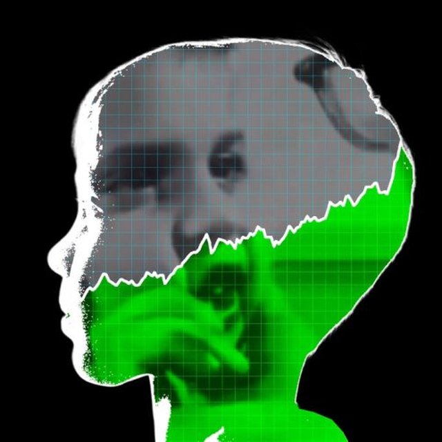 Private Equity Is Cashing in on Autism Therapy. Children Are Paying the Price